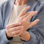 Rhizarthrose pouce photo : ce qu’une image peut vraiment montrer